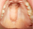 Inside of a mouth